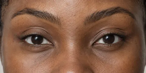 Ejemplo de ojos inclinados hacia arriba: las esquinas externas quedan más altas que las internas, un canthal tilt positivo.