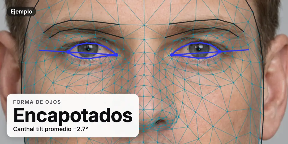 Resultado de ejemplo: la zona de los ojos de un hombre generado con IA con la malla de puntos y ojos leídos como encapotados y un canthal tilt promedio de +2.7°